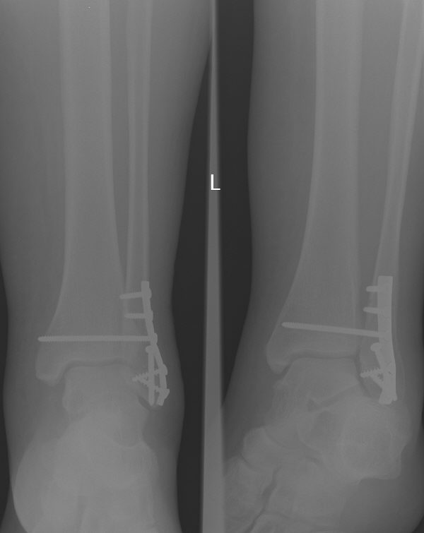 x ray.jpg