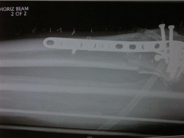 xray leg.jpg